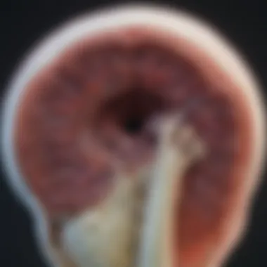 Advanced Imaging Techniques for Bone Metastasis Advanced imaging techniques for bone metastasis