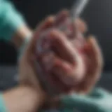 Surgical team performing aortic valve replacement