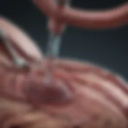 Diagram illustrating nephrectomy procedure