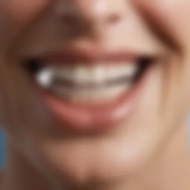 Causes of Teeth Discoloration Diagram illustrating various causes of teeth discoloration