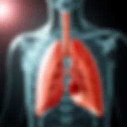 Diagram illustrating the structure of bronchial tubes affected by cylindrical bronchiectasis