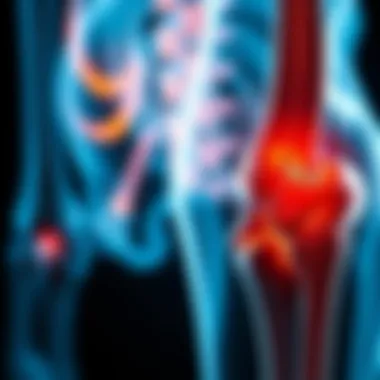 Understanding Pain Mechanisms in Bone Cancer Understanding pain mechanisms in bone cancer