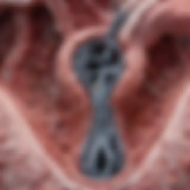 Visual representation of bronchiectasis pathology