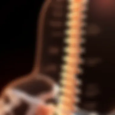 Mechanisms of Spinal Degeneration Diagram illustrating spinal degeneration mechanisms