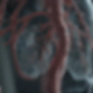 Ground Glass Opacity in Lung Imaging Radiological representation of ground glass opacity in lungs