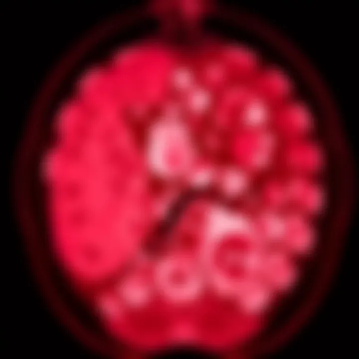 Imaging Techniques in Diagnosing IPMN Imaging scan showing cystic formations associated with IPMN
