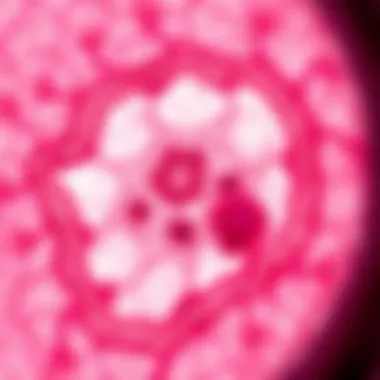 Pathological Characteristics of IPMN Cross-sectional view of pancreatic duct highlighted with IPMN lesions