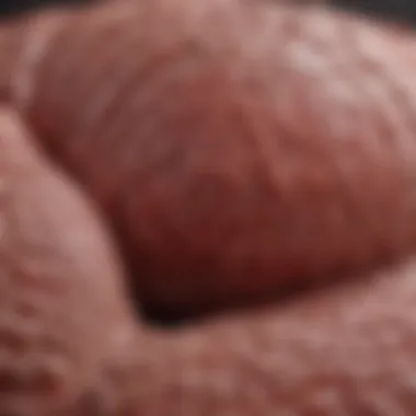 Treatment Options for Meat Allergies Triggered by Ticks Visualization of treatments for meat allergies