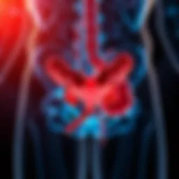 Illustration of the urinary tract affected by neurogenic bladder due to MS