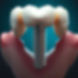 Detailed view of dental implant components