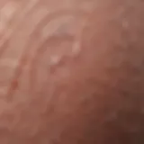 Close-up view of hypertrophic scar texture