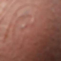 Close-up view of hypertrophic scar texture