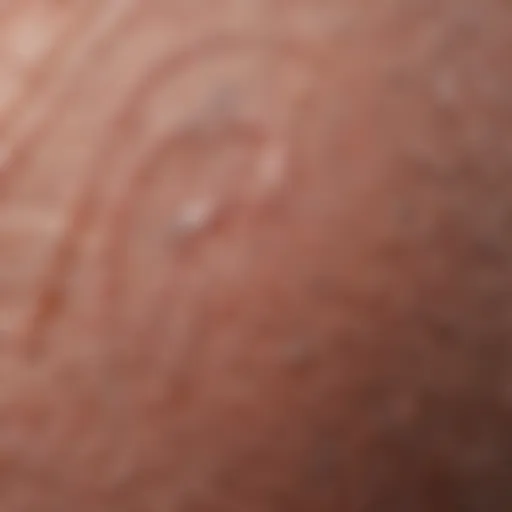Close-up view of hypertrophic scar texture