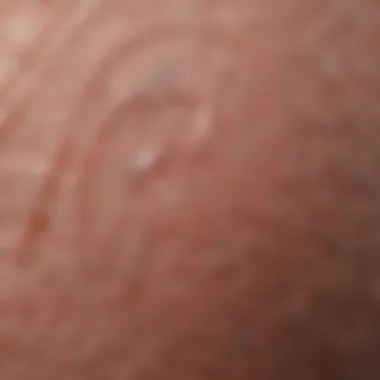 Hypertrophic Scar Texture Close-up view of hypertrophic scar texture