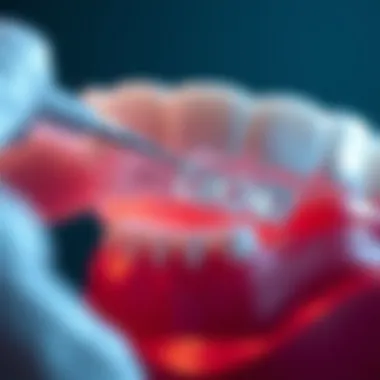 Benefits of Non-Invasive Caries Management with Silver Diamine Fluoride Benefits of non-invasive caries management with silver diamine fluoride