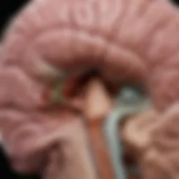 Detailed diagram of the thalamus showing infarction areas