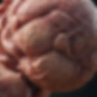 Visualization of Tumors with Ultrasound Ultrasound scan showing tumor visualization