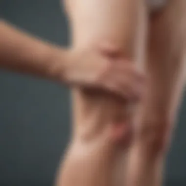 Management Strategies for Lymphedema Diagram illustrating management strategies for lymphedema