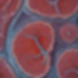 Lung tissue under microscopic examination showing interstitial changes