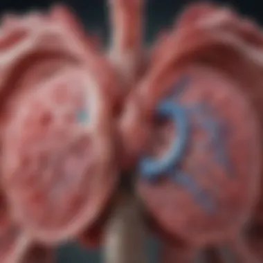 Pathological Features of Paraseptal Emphysema Pathological illustration of paraseptal emphysema