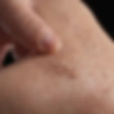 Physiological Aspects of Scratching Close-up of skin irritation caused by scratching