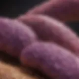 Visual representation of pancreatic cancer stages